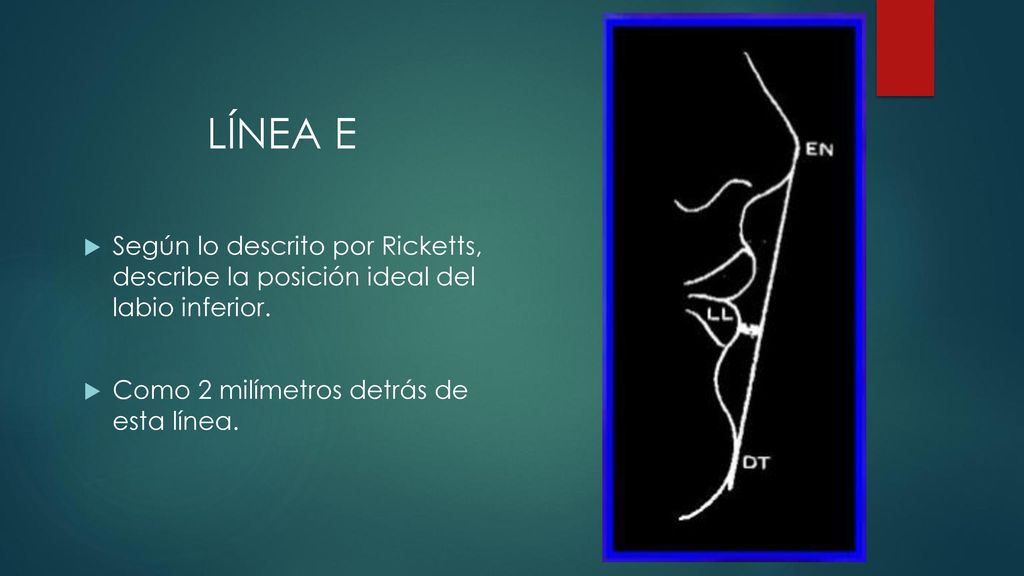 LÍNEA E Según lo descrito por Ricketts, describe la posición ideal del labio inferior.