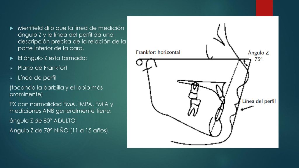 Merrifield dijo que la línea de medición ángulo Z y la línea del perfil da una descripción precisa de la relación de la parte inferior de la cara.