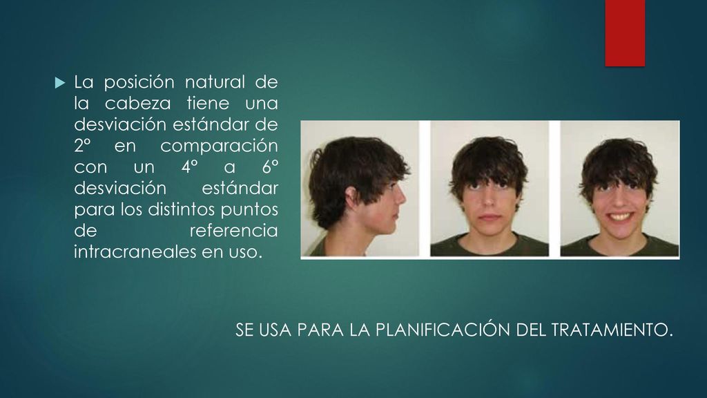 La posición natural de la cabeza tiene una desviación estándar de 2° en comparación con un 4° a 6° desviación estándar para los distintos puntos de referencia intracraneales en uso.