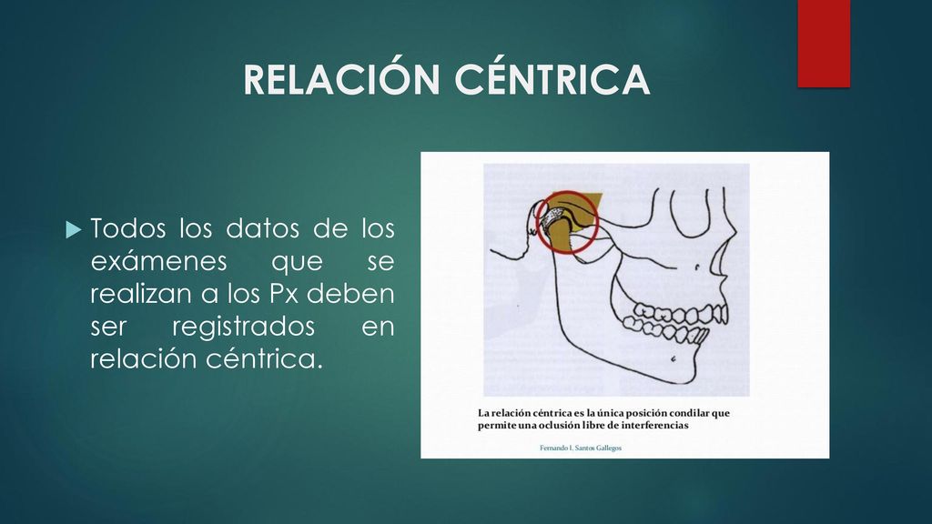RELACIÓN CÉNTRICA Todos los datos de los exámenes que se realizan a los Px deben ser registrados en relación céntrica.