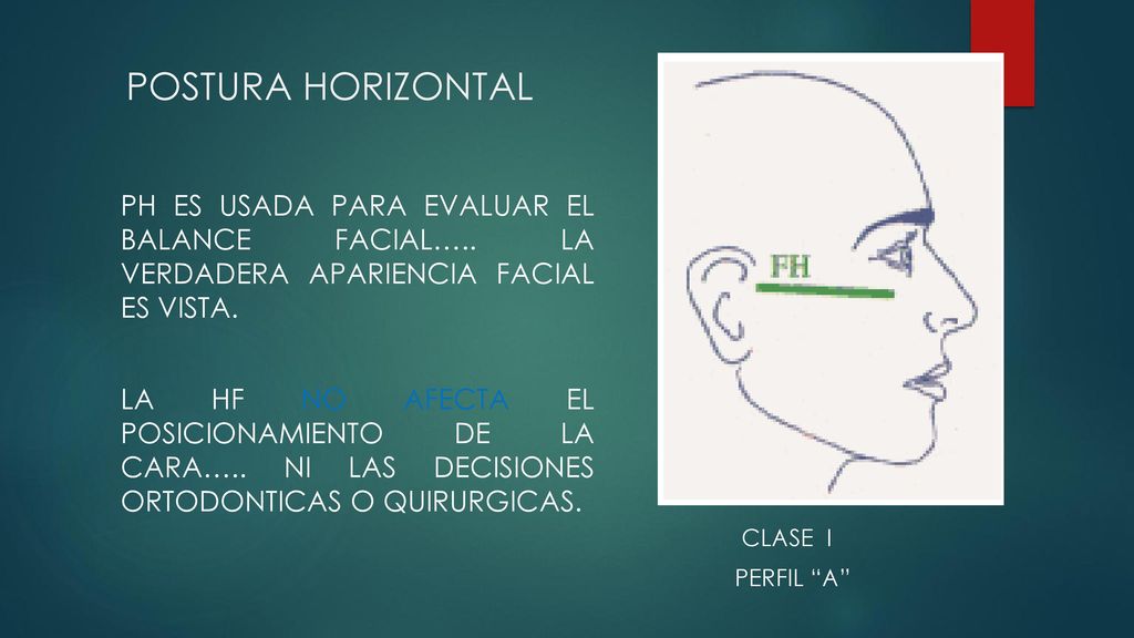 POSTURA HORIZONTAL CLASE I. PERFIL A PH ES USADA PARA EVALUAR EL BALANCE FACIAL….. LA VERDADERA APARIENCIA FACIAL ES VISTA.