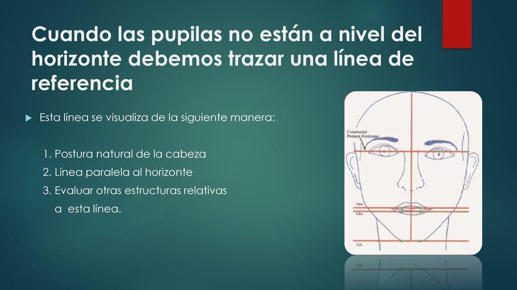 Cuando las pupilas no están a nivel del horizonte debemos trazar una línea de referencia