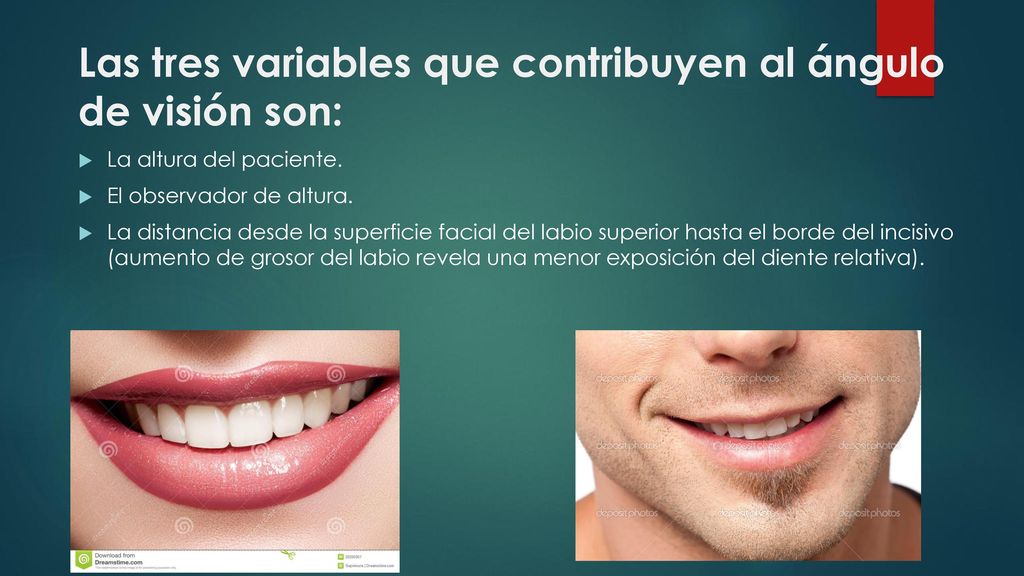 Las tres variables que contribuyen al ángulo de visión son: