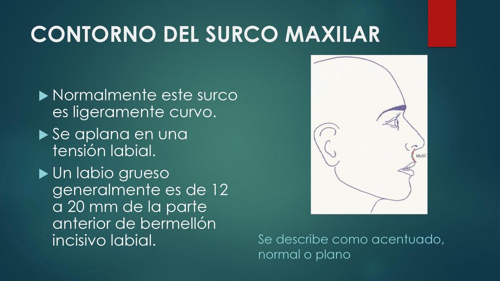 CONTORNO DEL SURCO MAXILAR
