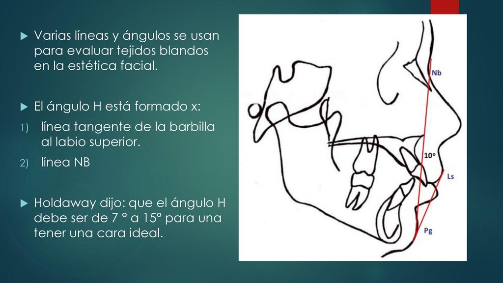 Varias líneas y ángulos se usan para evaluar tejidos blandos en la estética facial.