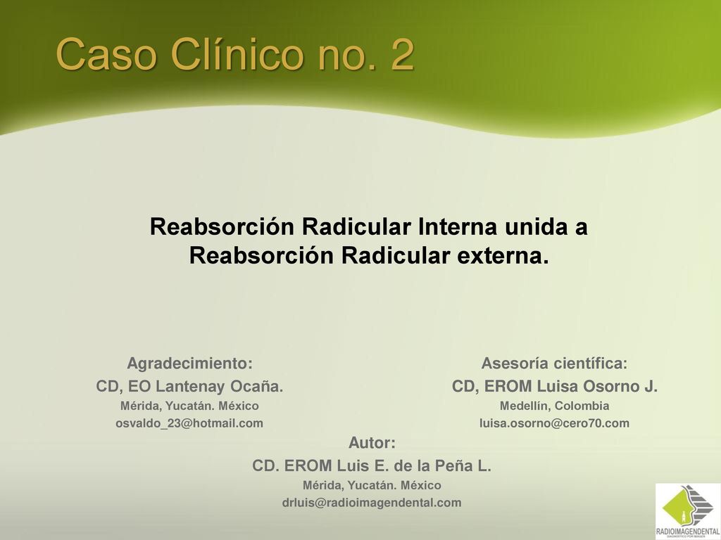 Reabsorción Radicular Interna unida a Reabsorción Radicular externa.