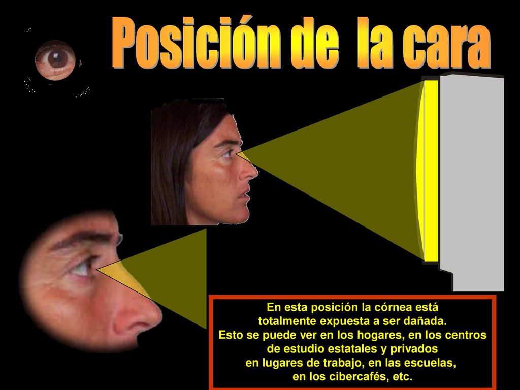 Posición de la cara En esta posición la córnea está