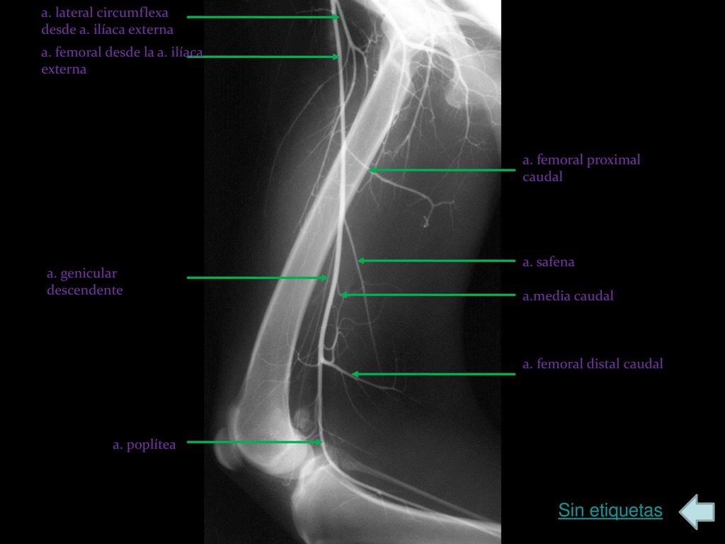 Sin etiquetas a. lateral circumflexa desde a. ilíaca externa