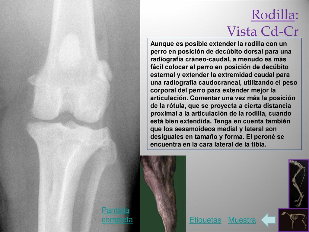 Rodilla: Vista Cd-Cr Pantalla completa Etiquetas Muestra