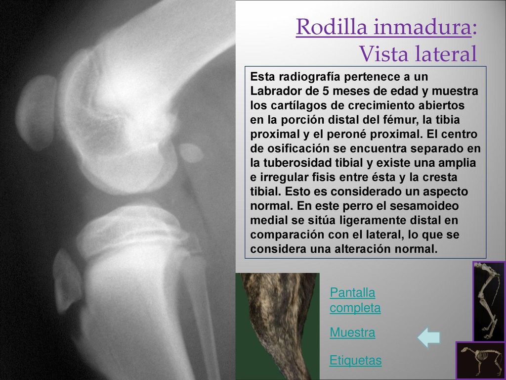 Rodilla inmadura: Vista lateral Pantalla completa Muestra Etiquetas