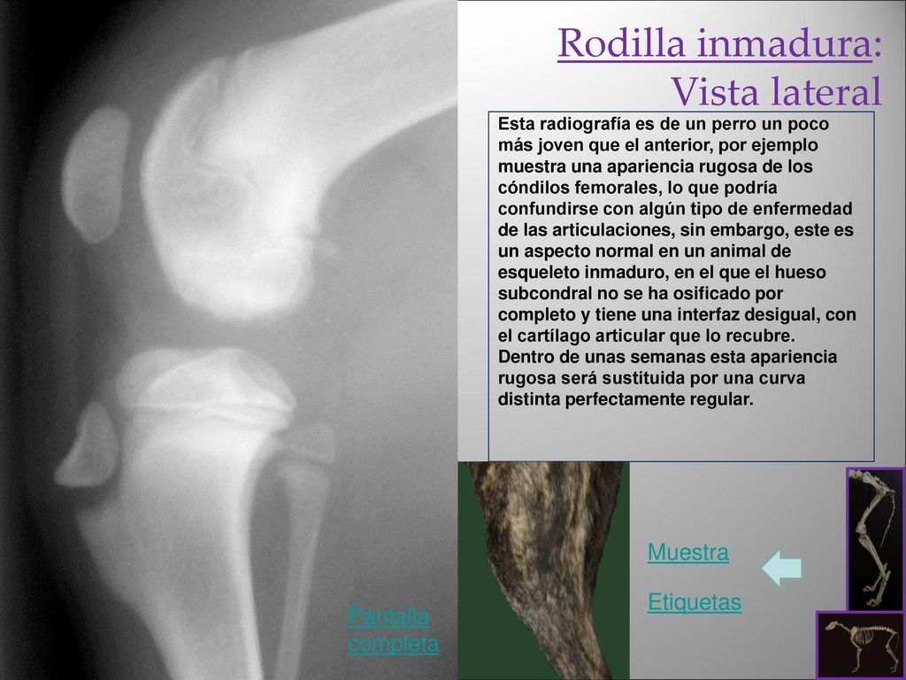 Rodilla inmadura: Vista lateral Muestra Etiquetas Pantalla completa