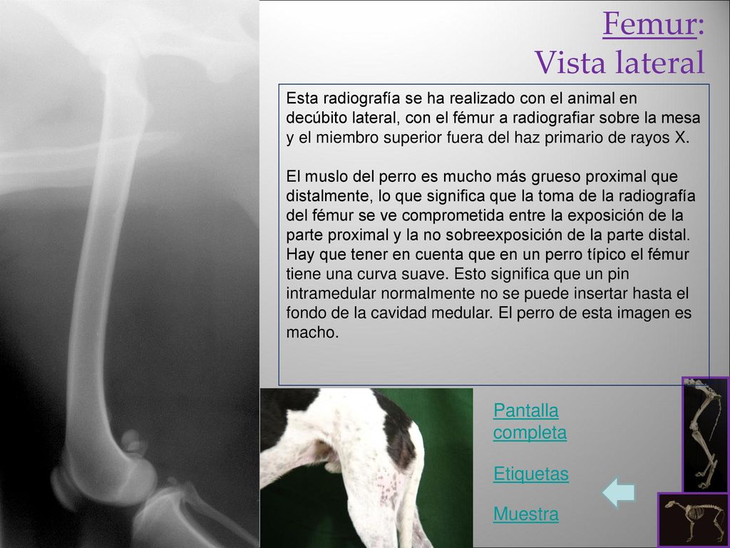 Femur: Vista lateral Pantalla completa Etiquetas Muestra