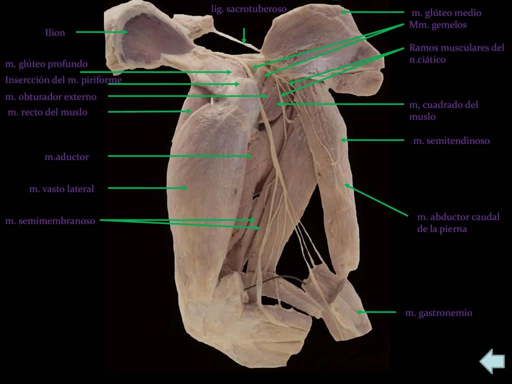 lig. sacrotuberoso m. glúteo medio. Mm. gemelos. Ilion. Ramos musculares del n.ciático. m. glúteo profundo.
