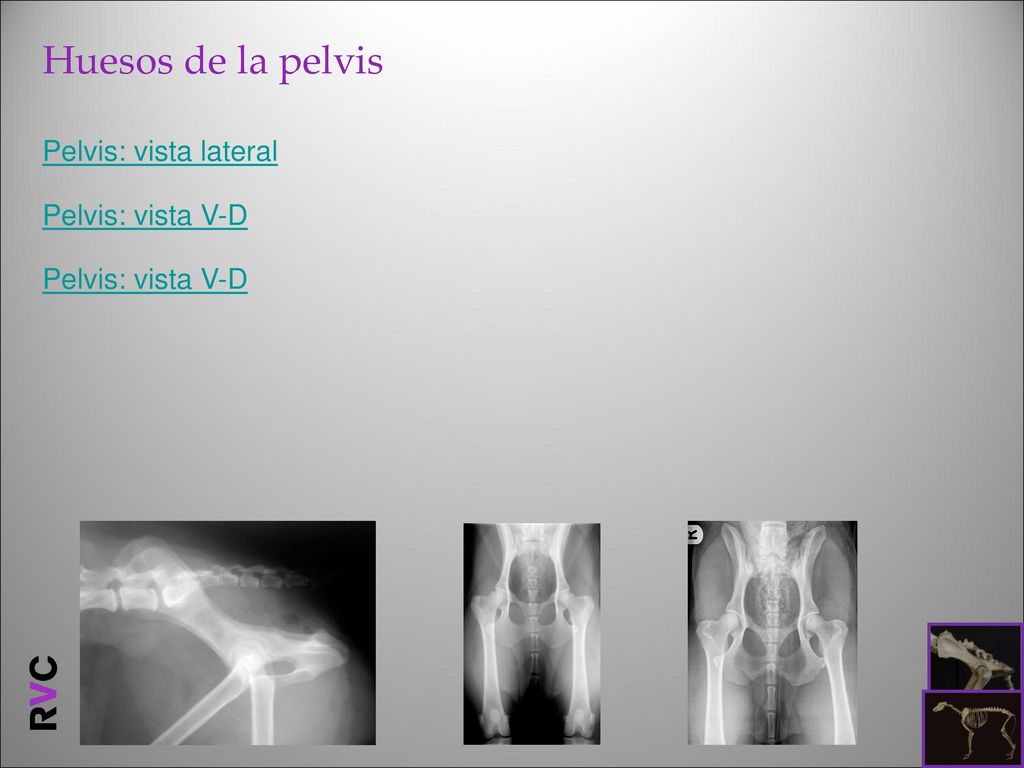 Huesos de la pelvis Pelvis: vista lateral Pelvis: vista V-D
