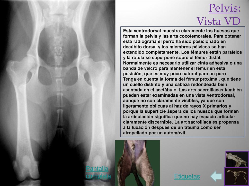 Pelvis: Vista VD Pantalla completa Etiquetas