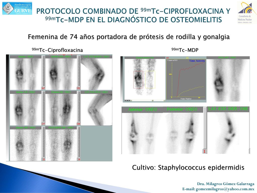 PROTOCOLO COMBINADO DE 99mTc-CIPROFLOXACINA Y 99mTc-MDP EN EL DIAGNÓSTICO DE OSTEOMIELITIS