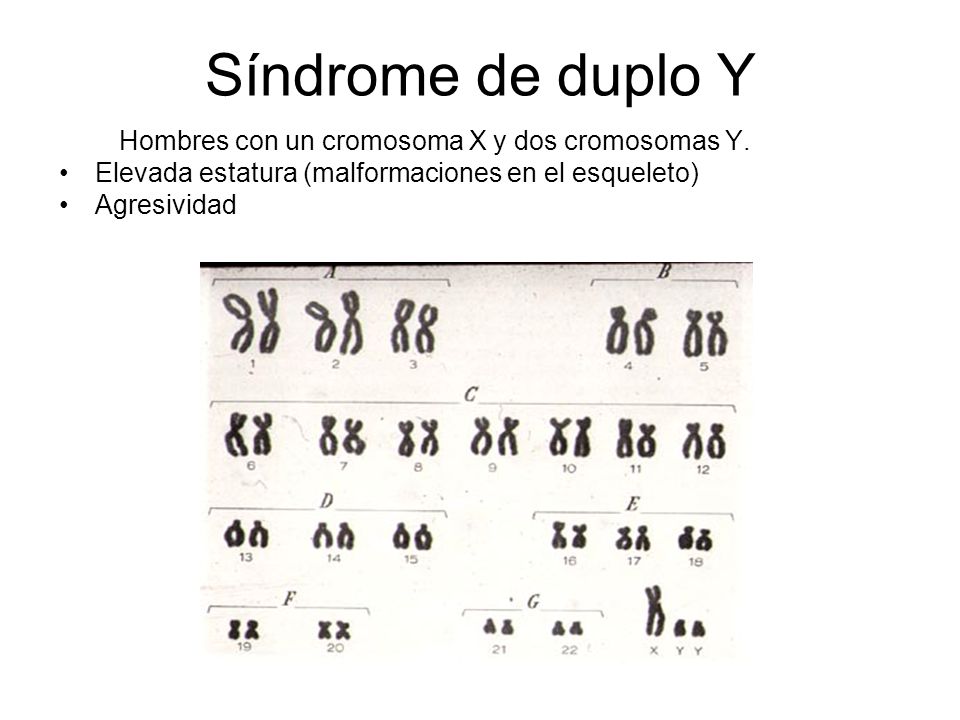 Hombres con un cromosoma X y dos cromosomas Y.