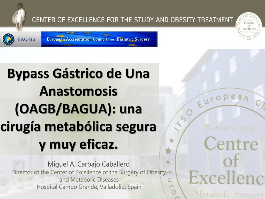 Bypass Gástrico de Una Anastomosis (OAGB/BAGUA): una cirugía metabólica segura y muy eficaz.