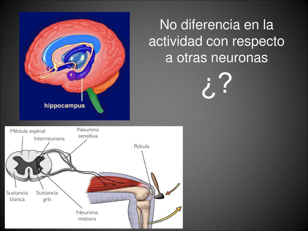 No diferencia en la actividad con respecto a otras neuronas ¿