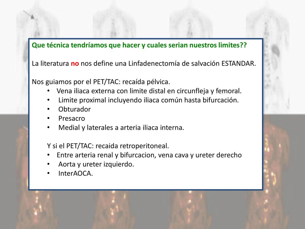 Que técnica tendríamos que hacer y cuales serian nuestros limites