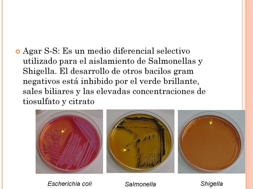 Agar S-S: Es un medio diferencial selectivo utilizado para el aislamiento de Salmonellas y Shigella.