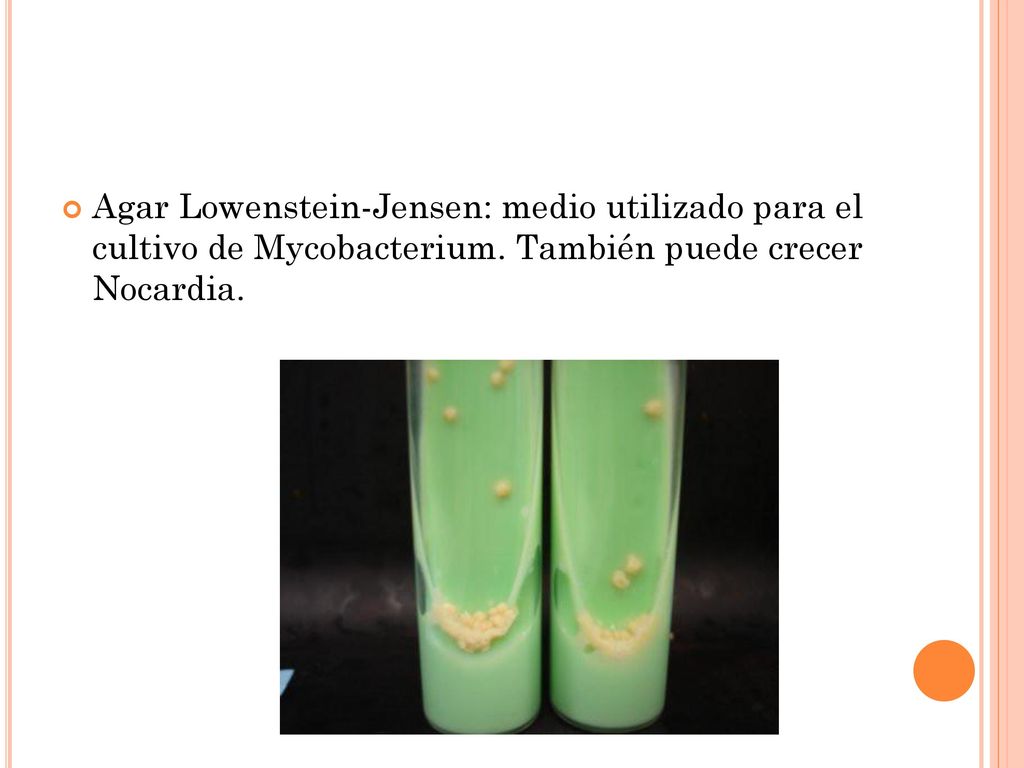 Agar Lowenstein-Jensen: medio utilizado para el cultivo de Mycobacterium.