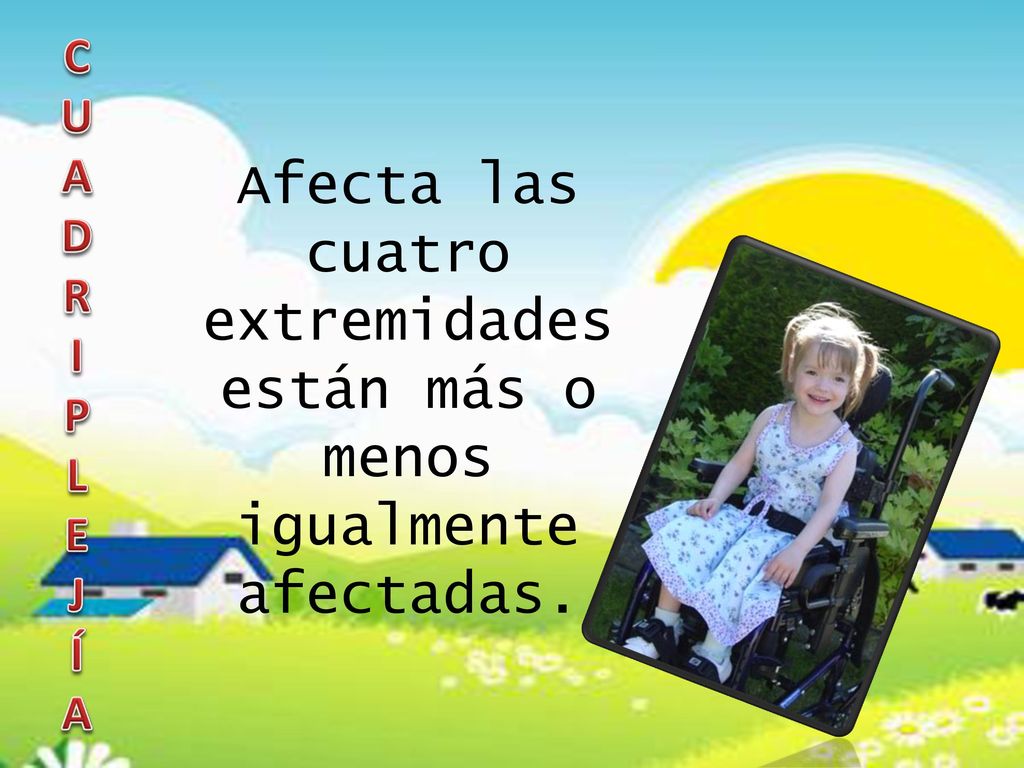 Afecta las cuatro extremidades están más o menos igualmente afectadas.