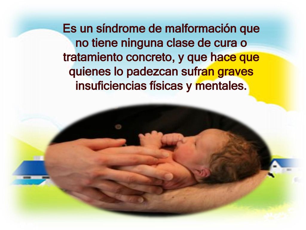 Es un síndrome de malformación que no tiene ninguna clase de cura o tratamiento concreto, y que hace que quienes lo padezcan sufran graves insuficiencias físicas y mentales.