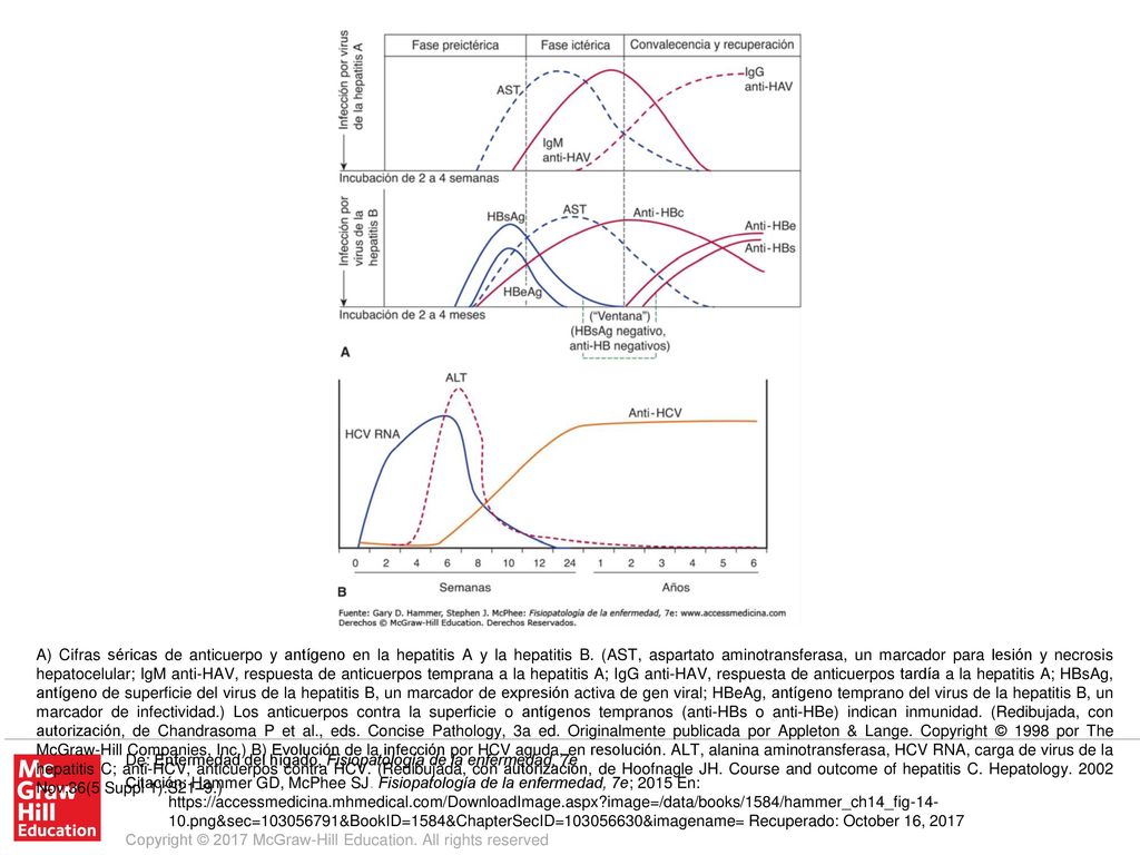 A) Cifras séricas de anticuerpo y antígeno en la hepatitis A y la hepatitis B. (AST, aspartato aminotransferasa, un marcador para lesión y necrosis hepatocelular; IgM anti-HAV, respuesta de anticuerpos temprana a la hepatitis A; IgG anti-HAV, respuesta de anticuerpos tardía a la hepatitis A; HBsAg, antígeno de superficie del virus de la hepatitis B, un marcador de expresión activa de gen viral; HBeAg, antígeno temprano del virus de la hepatitis B, un marcador de infectividad.) Los anticuerpos contra la superficie o antígenos tempranos (anti-HBs o anti-HBe) indican inmunidad. (Redibujada, con autorización, de Chandrasoma P et al., eds. Concise Pathology, 3a ed. Originalmente publicada por Appleton & Lange. Copyright © 1998 por The McGraw-Hill Companies, Inc.) B) Evolución de la infección por HCV aguda, en resolución. ALT, alanina aminotransferasa, HCV RNA, carga de virus de la hepatitis C; anti-HCV, anticuerpos contra HCV. (Redibujada, con autorización, de Hoofnagle JH. Course and outcome of hepatitis C. Hepatology Nov;36(5 Suppl 1):S21–9.)