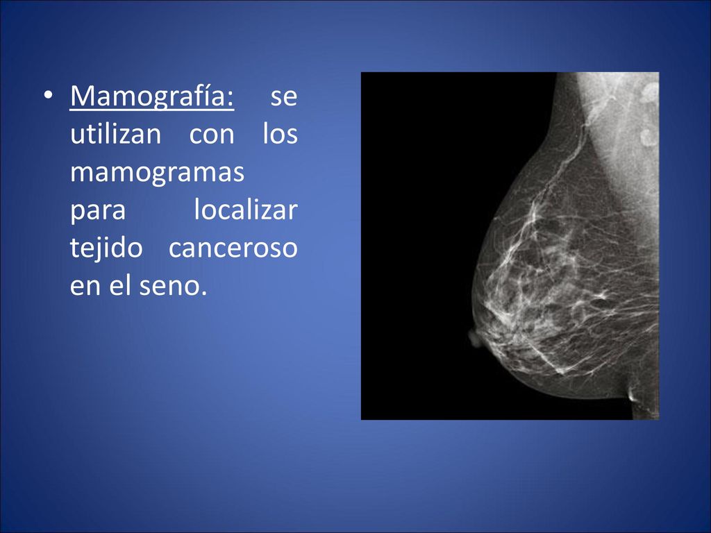 Mamografía: se utilizan con los mamogramas para localizar tejido canceroso en el seno.