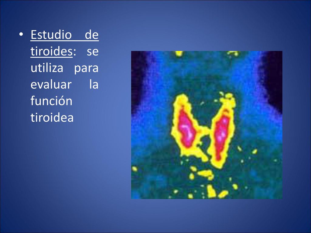 Estudio de tiroides: se utiliza para evaluar la función tiroidea