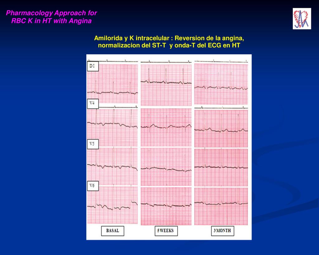 Pharmacology Approach for RBC K in HT with Angina