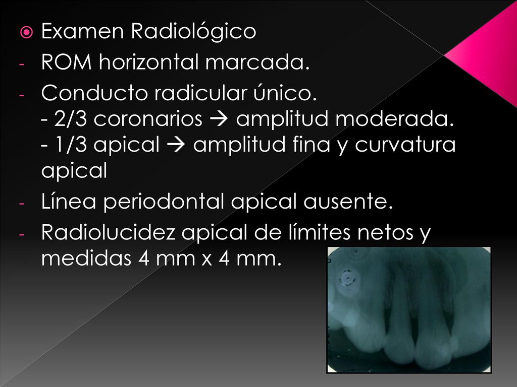 Examen Radiológico ROM horizontal marcada.