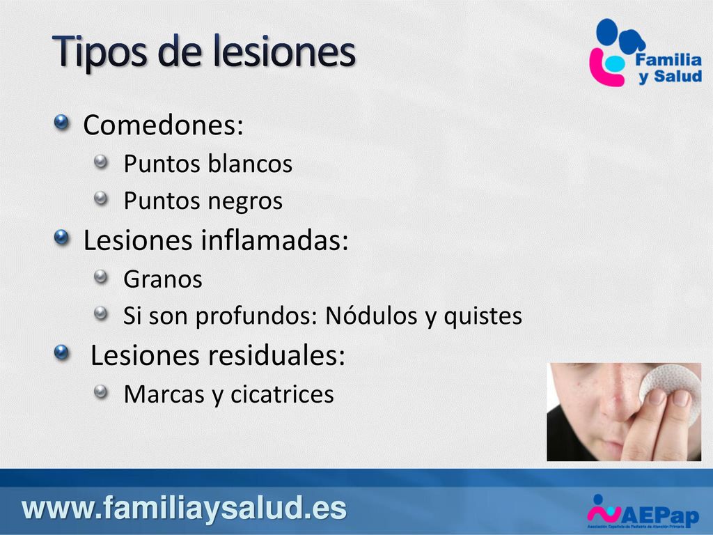 Tipos de lesiones Comedones: Lesiones inflamadas: Lesiones residuales: