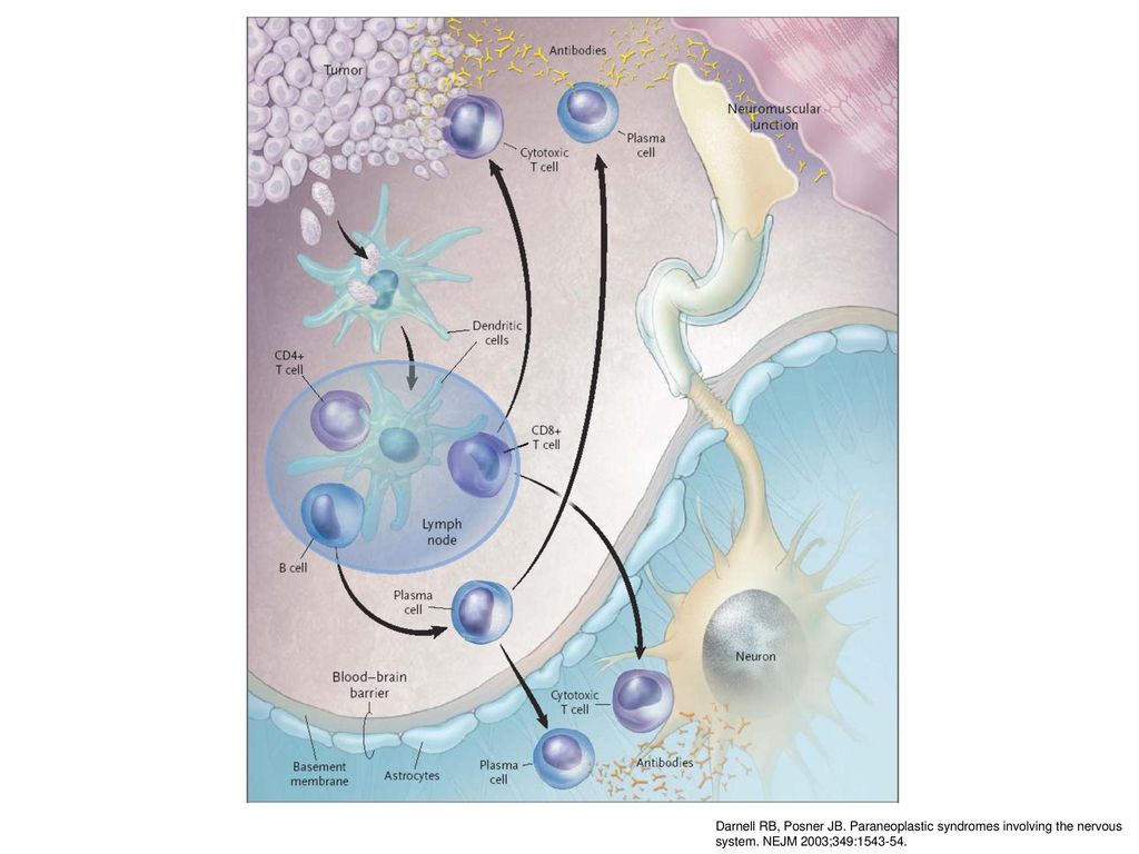 Darnell RB, Posner JB. Paraneoplastic syndromes involving the nervous system. NEJM 2003;349: