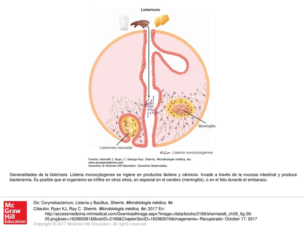 Generalidades de la listeriosis