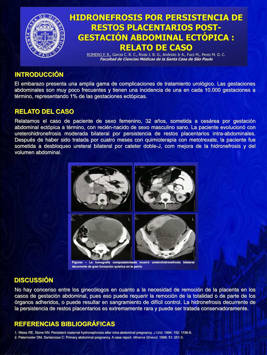 HIDRONEFROSIS POR PERSISTENCIA DE RESTOS PLACENTARIOS POST-GESTACIÓN ABDOMINAL ECTÓPICA : RELATO DE CASO ROMERO F. R., Garcia C. R. C., Rivas J. B. G., Andriolo Jr A., Fucs M., Perez M. D. C. Facultad de Ciencias Médicas de la Santa Casa de São Paulo