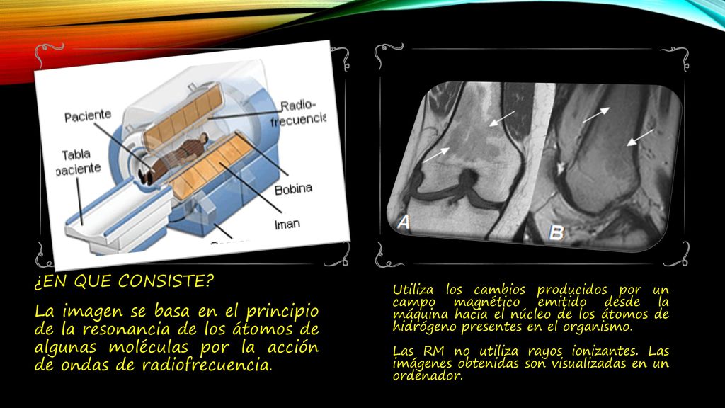 ¿EN QUE CONSISTE La imagen se basa en el principio de la resonancia de los átomos de algunas moléculas por la acción de ondas de radiofrecuencia.