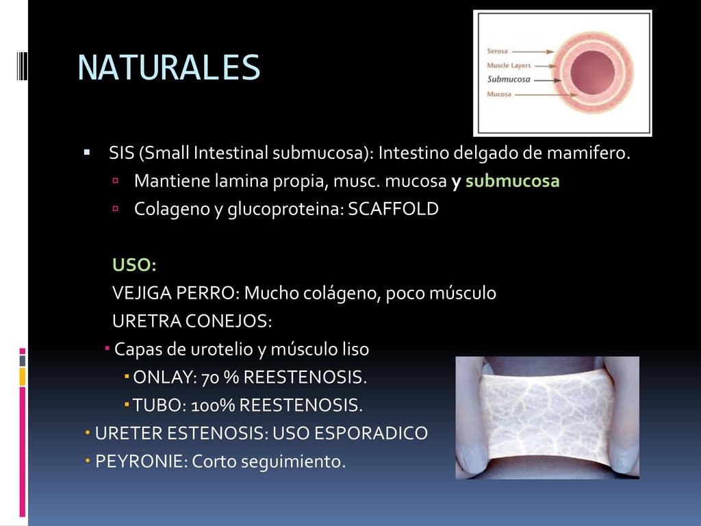 NATURALES SIS (Small Intestinal submucosa): Intestino delgado de mamifero. Mantiene lamina propia, musc. mucosa y submucosa.