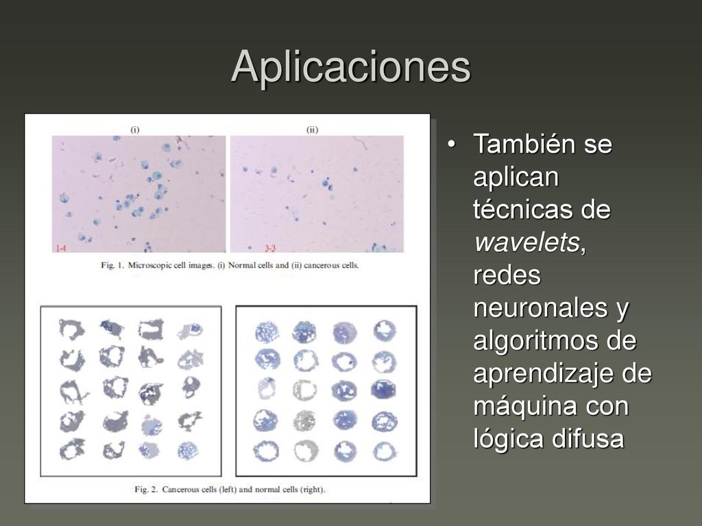 Aplicaciones También se aplican técnicas de wavelets, redes neuronales y algoritmos de aprendizaje de máquina con lógica difusa.