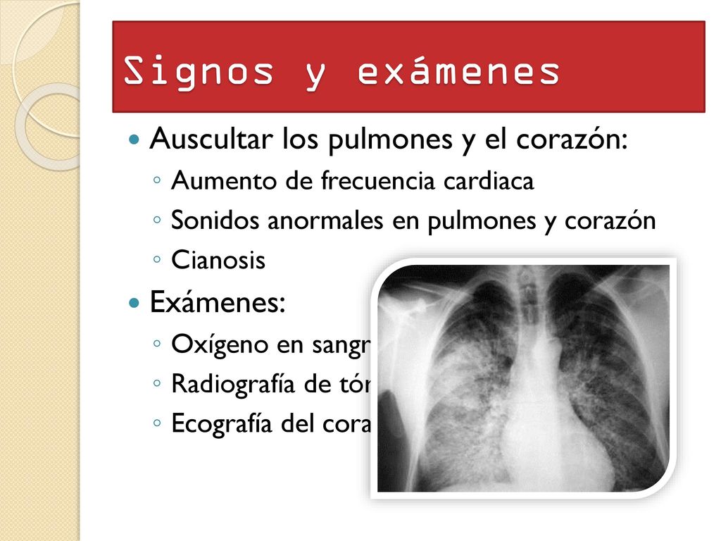 Signos y exámenes Auscultar los pulmones y el corazón: Exámenes: