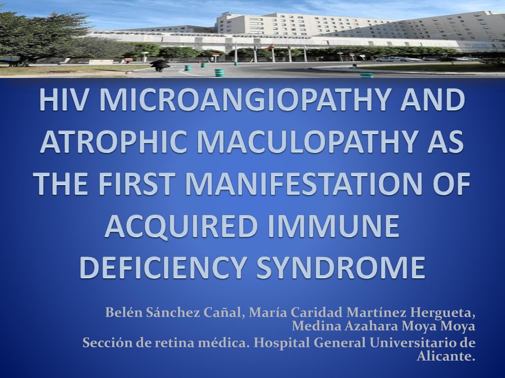 HIV MICROANGIOPATHY AND ATROPHIC MACULOPATHY AS THE FIRST MANIFESTATION OF ACQUIRED IMMUNE DEFICIENCY SYNDROME