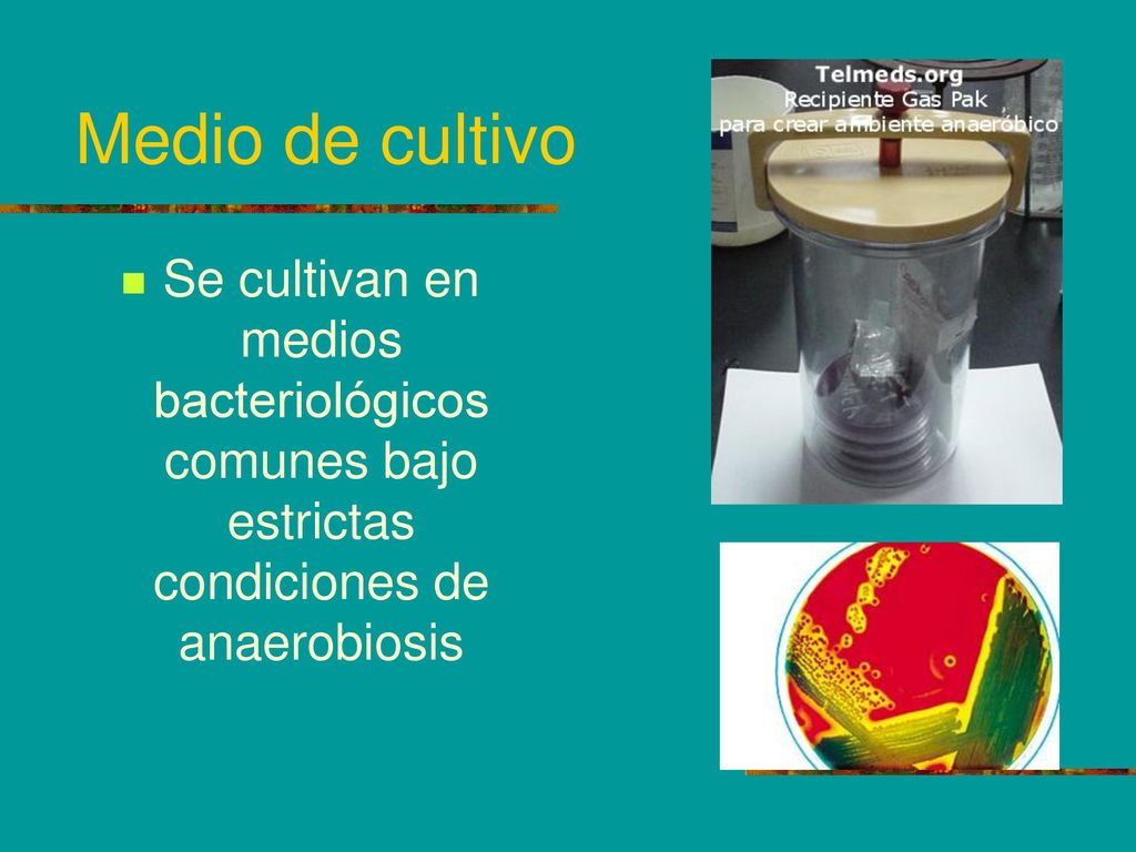 Medio de cultivo Se cultivan en medios bacteriológicos comunes bajo estrictas condiciones de anaerobiosis.