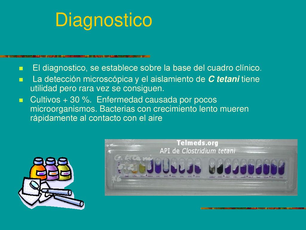 Diagnostico El diagnostico, se establece sobre la base del cuadro clínico.