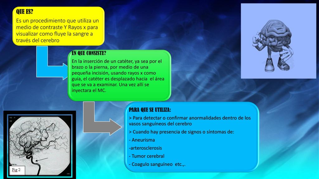 QUE ES Es un procedimiento que utiliza un medio de contraste Y Rayos x para visualizar como fluye la sangre a través del cerebro.