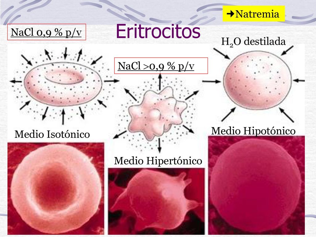 Eritrocitos Natremia NaCl 0,9 % p/v H2O destilada NaCl 0,9 % p/v