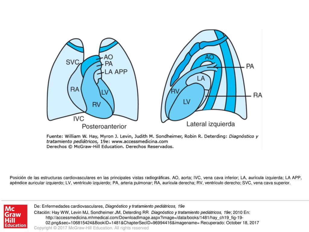 Posición de las estructuras cardiovasculares en las principales vistas radiográficas. AO, aorta; IVC, vena cava inferior; LA, aurícula izquierda; LA APP, apéndice auricular izquierdo; LV, ventrículo izquierdo; PA, arteria pulmonar; RA, aurícula derecha; RV, ventrículo derecho; SVC, vena cava superior.