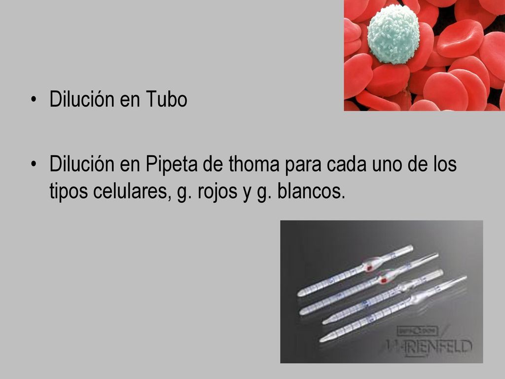 Dilución en Tubo Dilución en Pipeta de thoma para cada uno de los tipos celulares, g.
