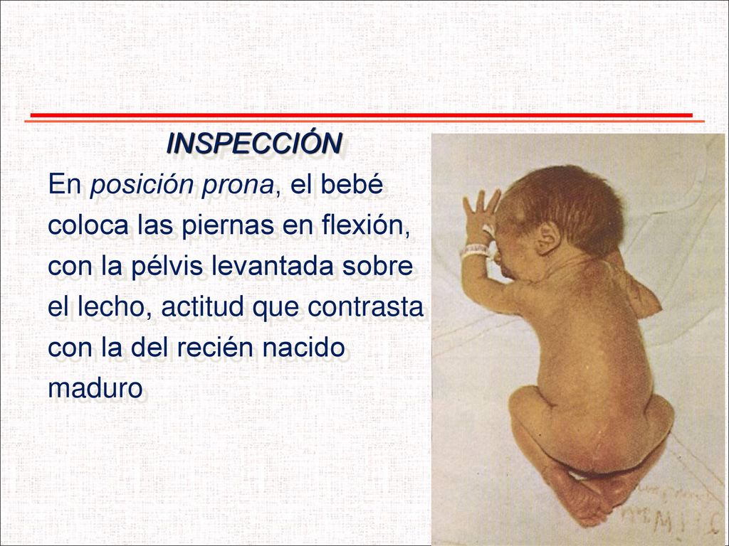 INSPECCIÓN En posición prona, el bebé. coloca las piernas en flexión, con la pélvis levantada sobre.