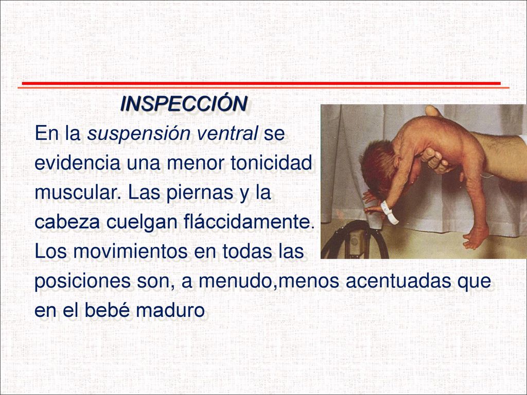 INSPECCIÓN En la suspensión ventral se. evidencia una menor tonicidad. muscular. Las piernas y la.